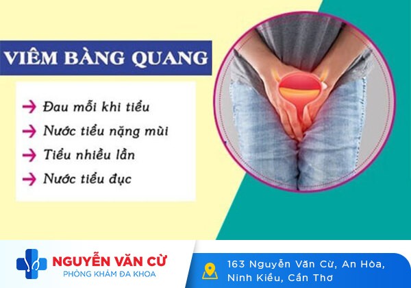 Bệnh Viêm Bàng Quang – Nguyên Nhân, Cách Điều Trị