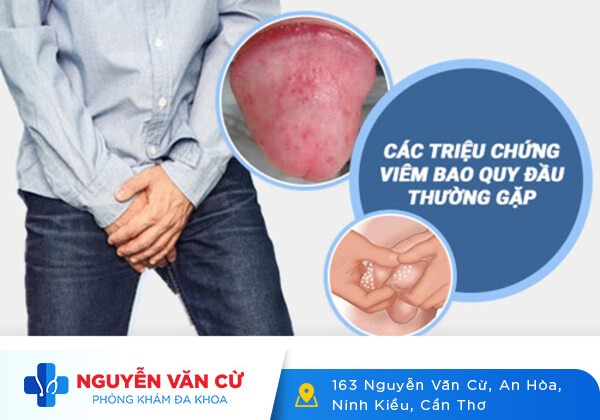 Bao quy đầu nổi đỏ, bao quy đầu nổi hạt có sao không?
