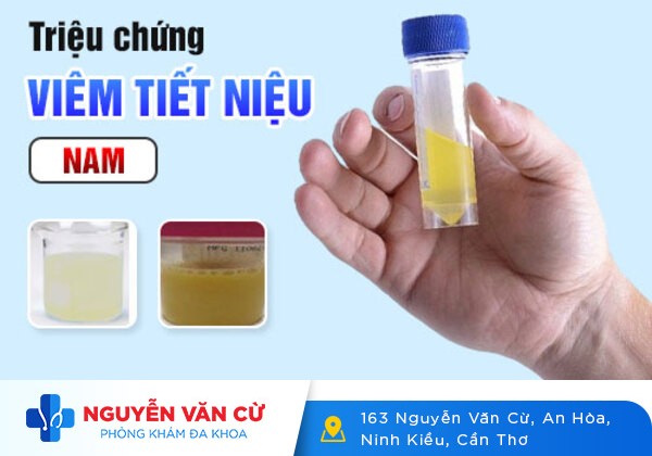 Phương pháp điều trị viêm đường tiết niệu hiệu quả hiện nay