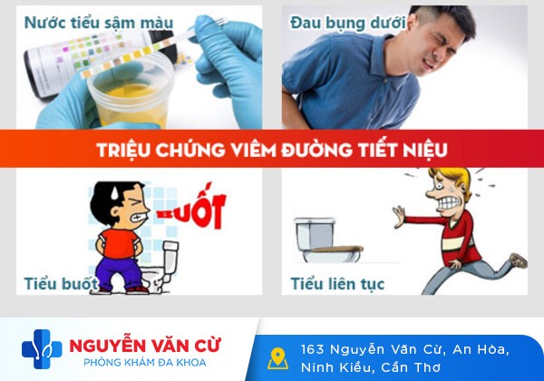 Bí Tiểu: Nguyên Nhân Và Cách Điều Trị Hiệu Quả