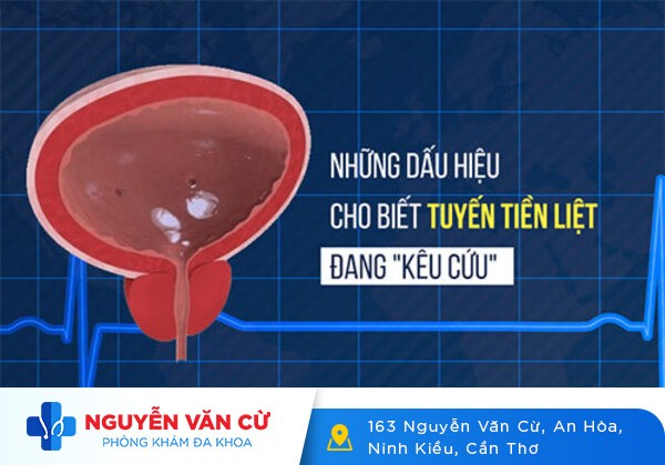 Đừng chủ quan khi bị đau tuyến tiền liệt