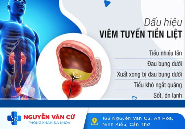 Những Phương Pháp Điều Trị Viêm Tuyến Tiền Liệt Đạt Hiệu Quả Cao