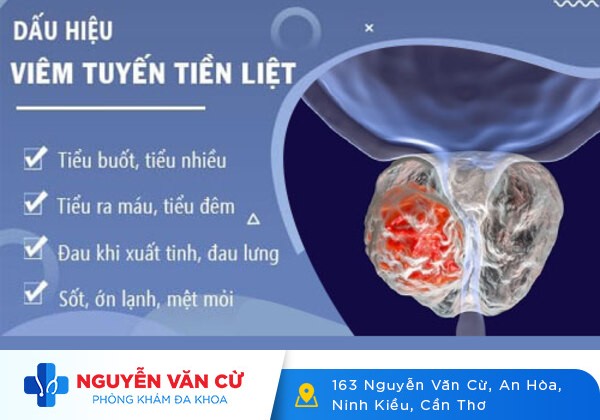 Tiểu rắt là dấu hiệu của bệnh gì?