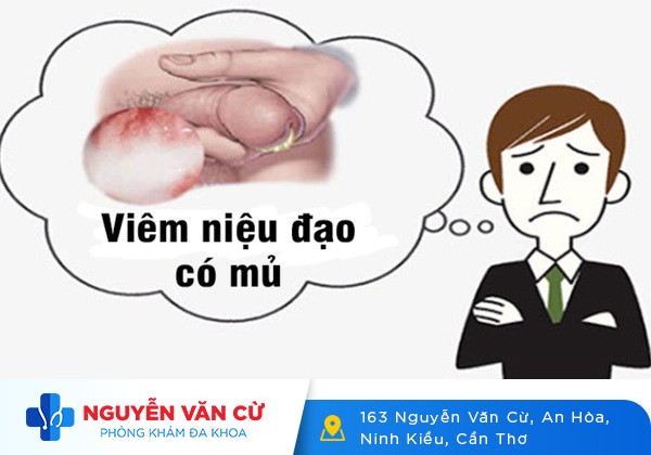 Niệu đạo chảy mủ có phải bệnh lậu không?