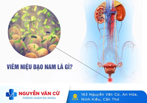 Viêm niệu đạo và những điều cả nam lẫn nữ giới cần phải biết