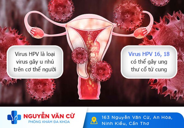 Sùi mào gà ở cổ tử cung – rất khó có thể nhận biết
