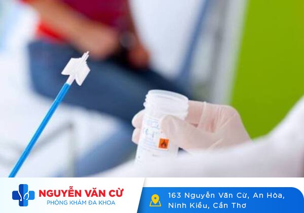 Xét nghiệm bệnh tình dục bao lâu có kết quả?