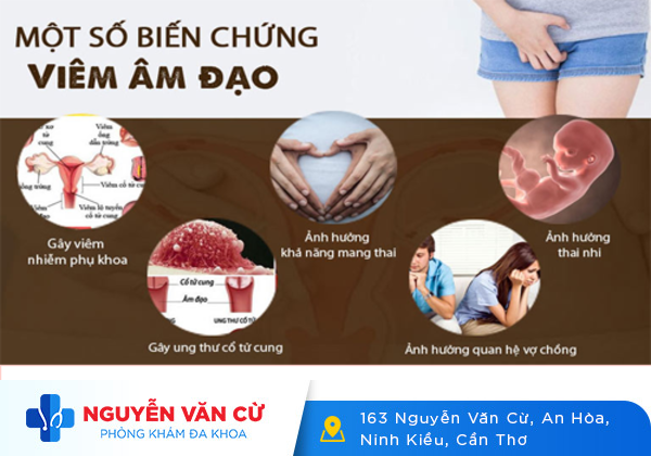 Viêm vùng kín – nỗi khổ tâm của chị em phụ nữ