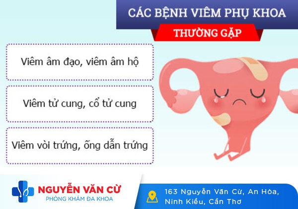 Phòng khám phụ khoa uy tín Cần Thơ