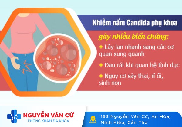 Nấm candida: Nguyên nhân, triệu chứng và cách khắc phục hiệu quả