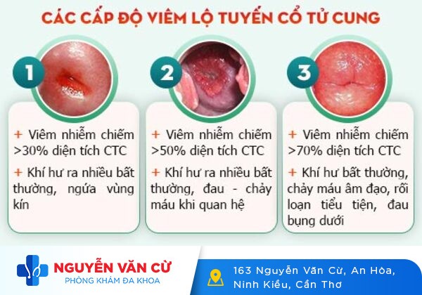 Chảy máu âm đạo – nguyên nhân và cách hỗ trợ điều trị
