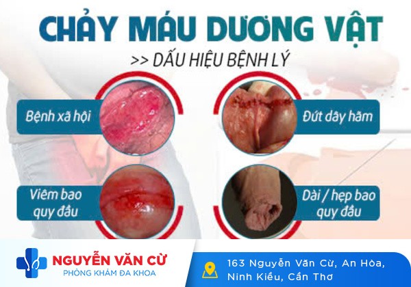 [Giải Đáp Thắc Mắc]: Dương vật ra máu là bị bệnh gì?