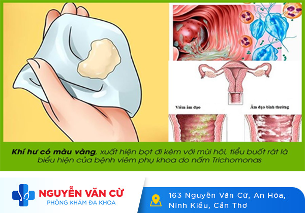 Bắt bệnh phụ khoa qua màu sắc bất thường của khí hư