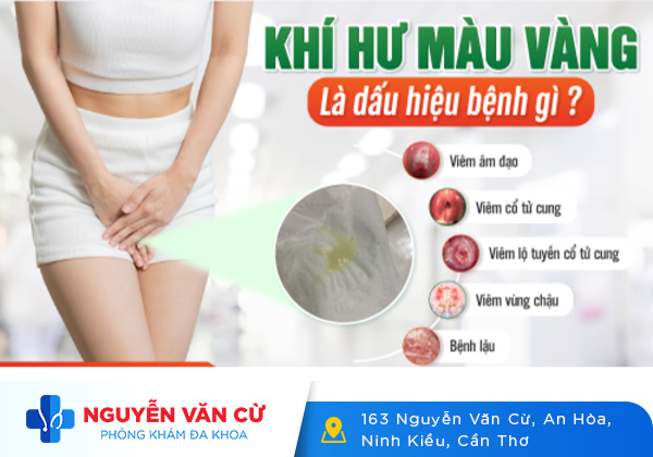 Khí Hư Có Màu Vàng Đục Là Bị Gì?