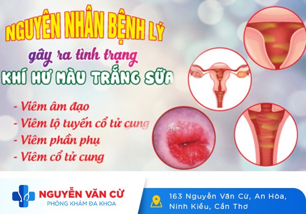 Khí hư màu trắng dấu hiệu tiềm ẩn nhiều bệnh phụ khoa nguy hiểm