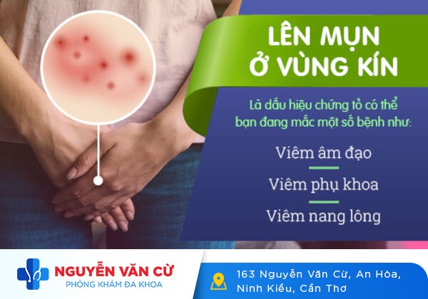 Có mụn ngứa ở âm đạo