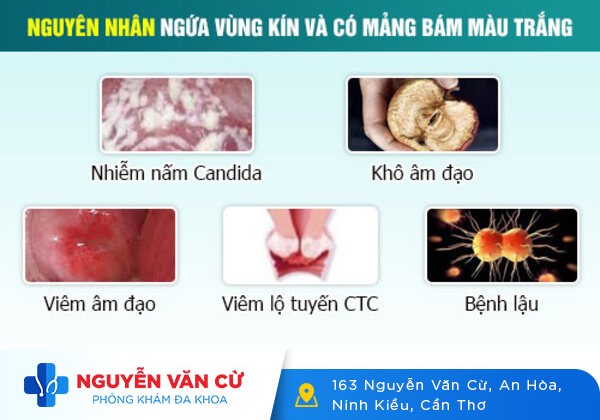 Ngứa phụ khoa – Bệnh tưởng đơn giản nhưng khó điều trị
