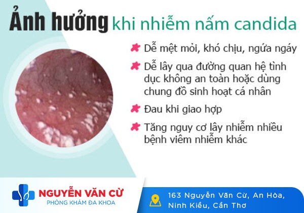 Nấm candida: Nguyên nhân, triệu chứng và cách khắc phục hiệu quả