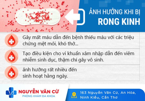 Rong kinh: nguyên nhân, dấu hiệu và cách điều trị hiệu quả