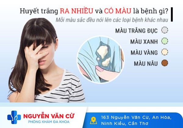 Bắt Bệnh Phụ Khoa Qua Màu Sắc Bất Thường Của Khí Hư