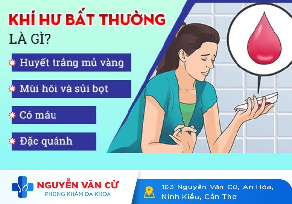 Cảnh giác với sự khác thường của huyết trắng