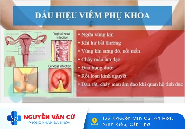 Viêm Phụ Khoa