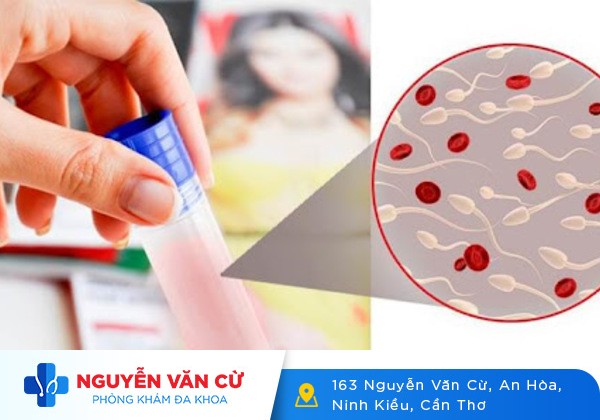 Xuất tinh ra máu dấu hiệu cảnh báo nhiều bệnh lý nguy hiểm
